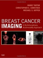 Breast Cancer Imaging: A Multidisciplinary Multimodality Approach