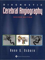 Diagnostic Cerebral Angiography,2/e