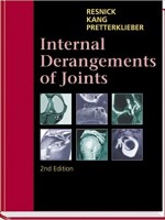 Internal Derangements of Joints,2/e(2vols)