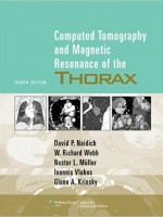 Computed Tomography and Magnetic Resonance of the Thorax 4/e