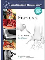 Master Techniques in Orthopaedic Surgery : Fractures, 3/e