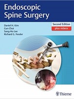 Endoscopic Spine Surgery , 2e