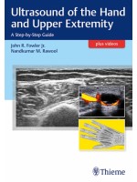 Ultrasound of the Hand and Upper Extremity A Step-by-Step Guide