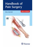 Handbook of Pain Surgery