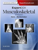 ExpertDDx: Musculoskeletal, 2e