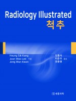 Radiology Illustrated : 척추
