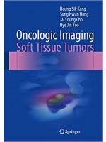 Oncologic Imaging: Soft Tissue Tumors