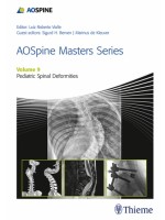 AOSpine Masters Series, Volume 9: Pediatric Spinal Deformities