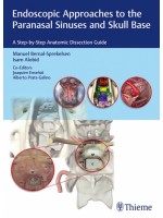 Endoscopic Approaches to the Paranasal Sinuses and Skull Base A Step-by-Step Anatomic Dissection Gui