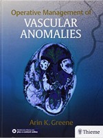 Operative Management of Vascular Anomalies