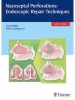 Nasoseptal Perforations: Endoscopic Repair Techniques