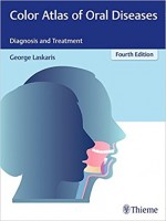 Color Atlas of Oral Diseases: Diagnosis and Treatment ,4e