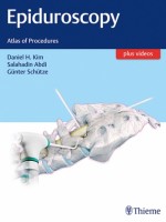 Epiduroscopy: Atlas of Procedures