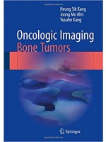 Oncologic Imaging: Bone Tumors