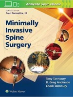 Minimally Invasive Spine Surgery