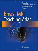 Breast MRI Teaching Atlas