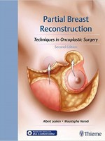 Partial Breast Reconstruction: Techniques in Oncoplastic Surgery