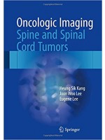 Oncologic Imaging: Spine and Spinal Cord Tumors