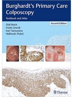 Burghardt's Primary Care Colposcopy