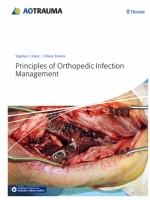 Principles of Orthopedic Infection Management