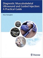 Diagnostic Musculoskeletal Ultrasound and Guided Injection: A Practical Guide 1st Edition
