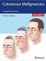 Cutaneous Malignancies: A Surgical Perspective 1st Edition