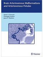 Brain Arteriovenous Malformations and Arteriovenous Fistulas 1st Edition