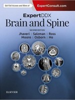 ExpertDDx: Brain and Spine, 2e