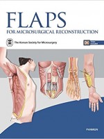Flaps for Microsurgical Reconstruction
