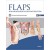 Flaps for Microsurgical Reconstruction