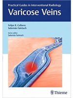 Varicose Veins: Practical Guides in Interventional Radiology