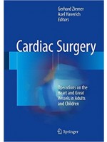 Cardiac Surgery