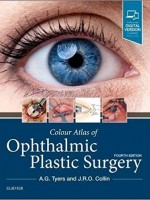 Colour Atlas of Ophthalmic Plastic Surgery, 4/e