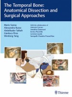The Temporal Bone Anatomical Dissection and Surgical Approaches