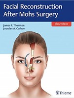 Facial Reconstruction After Mohs Surgery 1st Edition