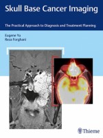 Skull Base Cancer Imaging: The Practical Approach to Diagnosis and Treatment Planning 1st Edition