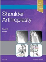 Shoulder Arthroplasty, 2/e