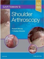 Gartsman's Shoulder Arthroscopy, 3/e