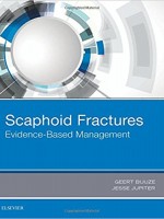 Scaphoid Fractures