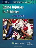 Spine Injuries in Athletes