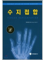 수지접합 - FINGER REPLANTATION