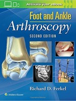 Foot & Ankle Arthroscopy, 2/e