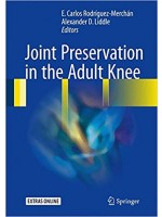 Joint Preservation in the Adult Knee