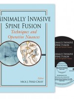 Minimally Invasive Spine Fusion: Techniques and Operative Nuances Book & 2-DVD Set