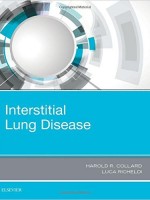 Interstitial Lung Disease, 1e