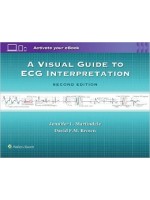 A Visual Guide to ECG Interpretation, 2e [Rapid Interpretation of Ecgs in Emergency Medicine 개정판]