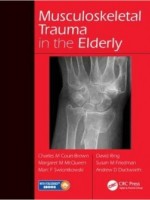 Musculoskeletal Trauma in the Elderly