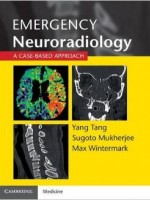 Emergency Neuroradiology: A Case-Based Approach