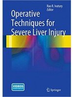 Operative Techniques for Severe Liver Injury