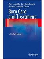 Burn Care and Treatment: A Practical Guide